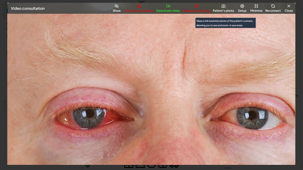 External Eye Image Capture